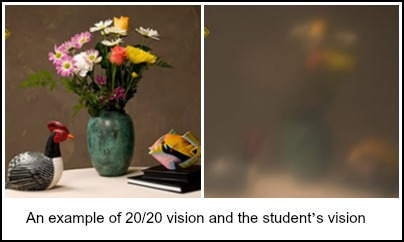 two images comparing normal vision to what student can see