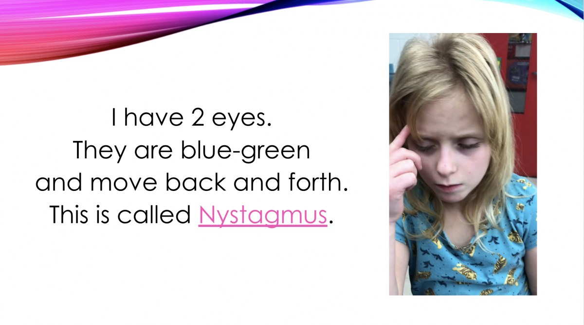 I have 2 eyes. They are blue-green and move back and forth. This is called Nystagmus.